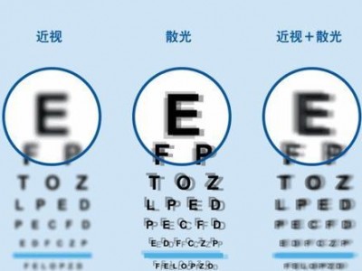 兰州普瑞眼科医院专业吗 全飞秒手术能治疗散光吗